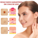 Removix® - Remova Verrugas, Manchas e Marcas com Rapidez e Eficácia! |COMPRE 1 LEVE 2|